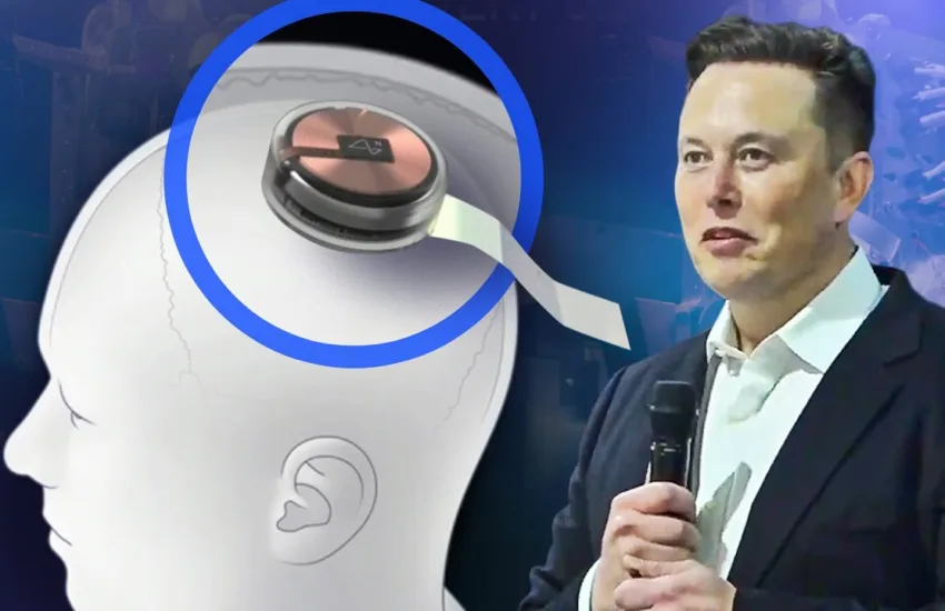 Elon Musk's Neuralink